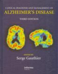 Image of Alzheimer's Disease