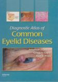 Image of Diagnostic Atlas of Common Eyelid Diseases