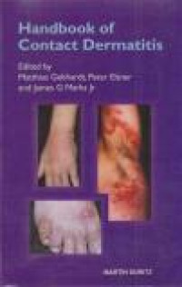 Image of Handbook oh Contact Dermatitis