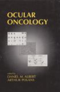 Image of Ocular Oncology