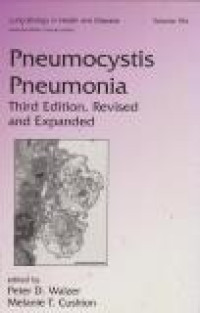 Image of Pneumocystis Pneumonia