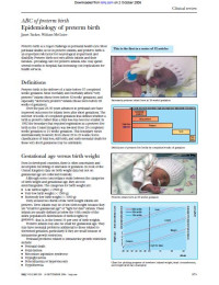 Image of ABC of Preterm Birth