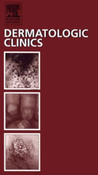 Image of Photodynamic Therapy : An Issue of Dermatologic Clinics
